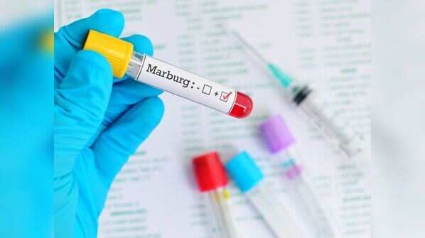 Marburg Virus disease