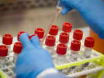 Should we scared of other pandemics?
