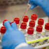 Should we scared of other pandemics?