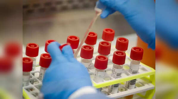 Should we scared of other pandemics?