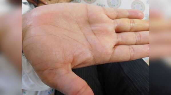 The money line in our palm