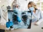 COVID-19 and its impact on respiratory health