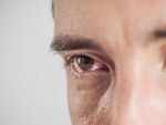 Sore eyes are a tell-tale sign of COVID, study claims