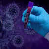 How is the COVID new strain diagnosed?