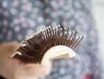 Hair loss in long haulers, as per new study
