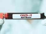 How can you check if you have already had COVID-19?