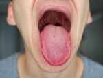 Changes to the colour/ sensation of the tongue
