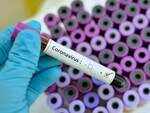 Could low viral load cause false negatives?