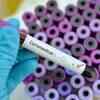 Could low viral load cause false negatives?