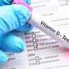 Vitamin D test