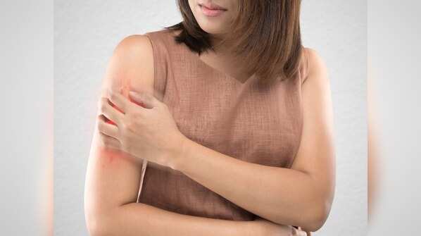 Skin problems