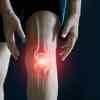 ​Joint issues