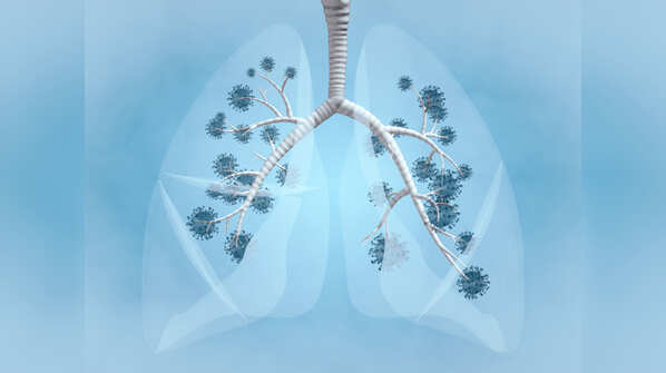 Lungs infection