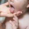 Irregular skin rashes