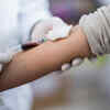 Swelling in arms