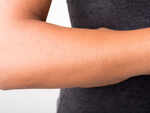 ​Skin lesions