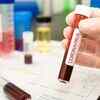 Doctors concerned over blood clot issues