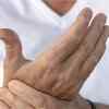Article image for: Lupus and other <i class="tbold">autoimmune condition</i>s