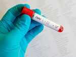How is Cytomegalovirus affecting COVID-19 patients?