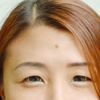 Forehead
