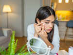Acne treatment