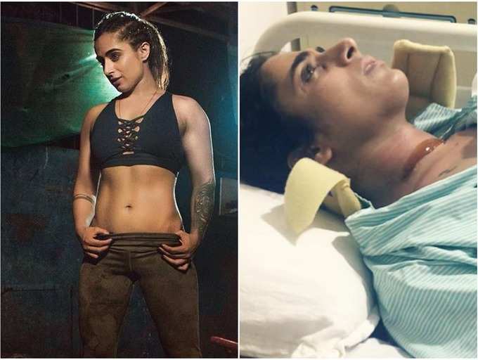 Shweta Mehta | Exclusive - Roadies ex-winner Shweta Mehta on her near-fatal accident: Got 7 fractures in my neck; took 2 years to recover and went financially broke
