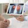 Lung fibrosis and high involvement
