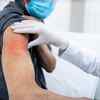 How does an adverse reaction differ from a mild one?