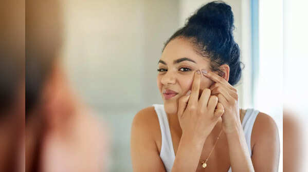 Treat your acne