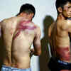 Two Afghan journalists were left with ugly welts and bruises after being beaten and detained for hours by Taliban fighters for covering a protest in the Afghan capital.