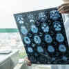 Early diagnosis is important, signs to watch out for