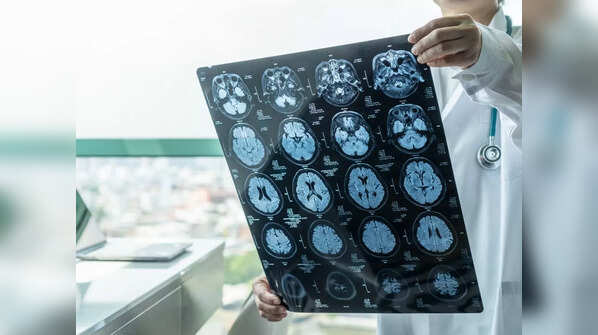 Early diagnosis is important, signs to watch out for