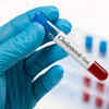 How to diagnose high cholesterol levels?