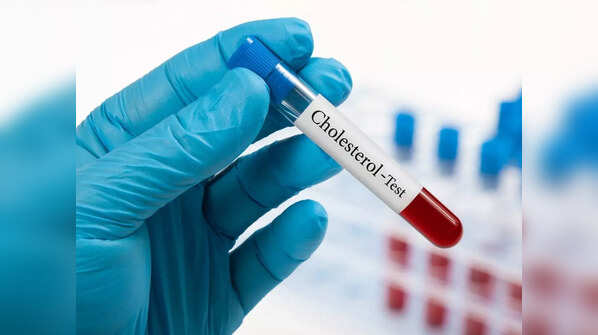 How to diagnose high cholesterol levels?