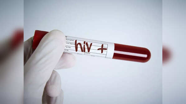 HIV/AIDS