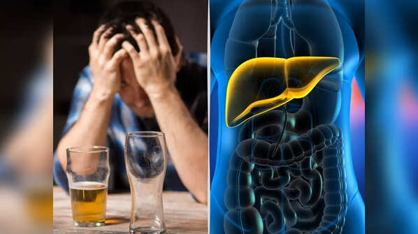 Excess alcohol consumption can lead to liver damage