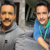 Aditya Narayan bruised eye with stitches
