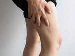 Reddened, warm skin around the affected area, resulting from an inflammation