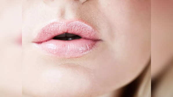 Pale lips