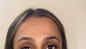 How To Conceal Your Dark Circles The Right Way