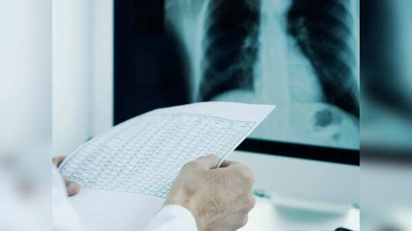 Advancement of conditions like bronchitis and COPD