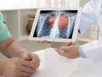 Accelerated ageing of lungs