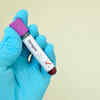 Your body can suffer from dengue shock syndrome