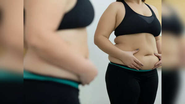 Weight loss surgeries