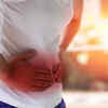 ​People with kidney stones