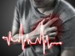 ​People with irregular heartbeat