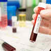 Why is dengue reinfection a possibility?