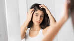 How to prevent your scalp from dandruff during winter?