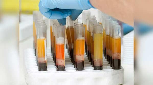 The second wave of COVID-19 called for many experimental treatments