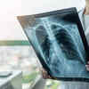 When should you seek medical attention?